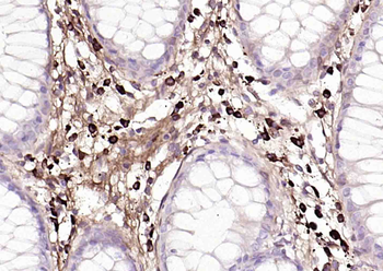 Human IgA Mouse Monoclonal Antibody