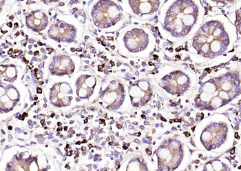 Human IgA Mouse Monoclonal Antibody