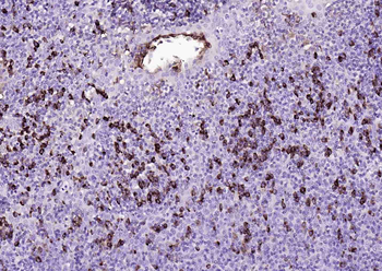 Human IgA Mouse Monoclonal Antibody