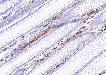 CD38 Mouse Monoclonal Antibody