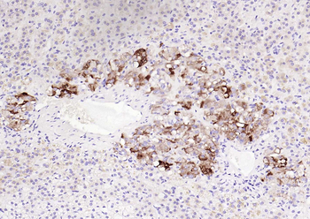 CHGA Mouse Monoclonal Antibody
