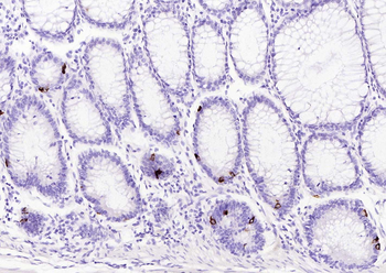 CHGA Mouse Monoclonal Antibody