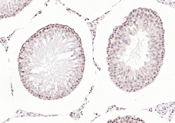 PMS2 Mouse Monoclonal Antibody