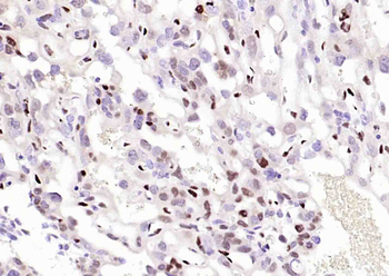 P57 Kip2 Mouse Monoclonal Antibody