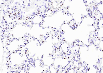 TTF1/NKX2-1 Mouse Monoclonal Antibody