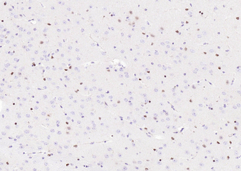 SOX2 Recombinant Rabbit Monoclonal Antibody