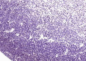 SOX2 Recombinant Rabbit Monoclonal Antibody