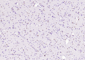 SOX2 Recombinant Rabbit Monoclonal Antibody