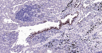 SOX2 Recombinant Rabbit Monoclonal Antibody