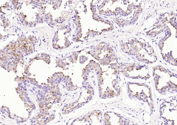FOLH1 Recombinant Rabbit Monoclonal Antibody