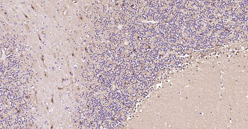 NSE Recombinant Rabbit Monoclonal Antibody