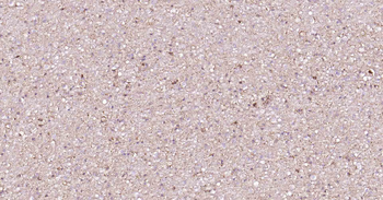 NSE Recombinant Rabbit Monoclonal Antibody