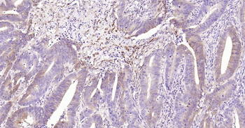 NSE Recombinant Rabbit Monoclonal Antibody