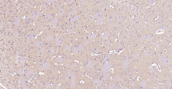 NSE Recombinant Rabbit Monoclonal Antibody