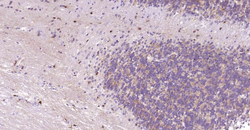 NSE Recombinant Rabbit Monoclonal Antibody