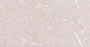 NSE Recombinant Rabbit Monoclonal Antibody