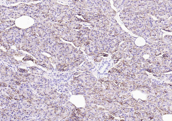 ENPP1 Recombinant Rabbit Monoclonal Antibody