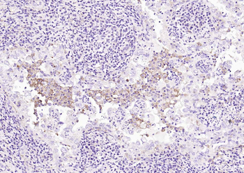 CD16a Recombinant Rabbit Monoclonal Antibody