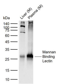 Mannan Binding Lectin Recombinant Rabbit Monoclonal Antibody