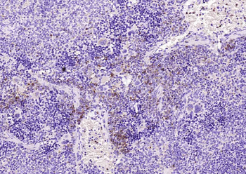 CD63 Recombinant Rabbit Monoclonal Antibody