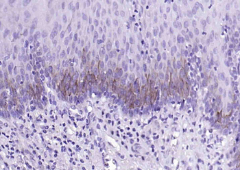 Bax Recombinant Rabbit mAb