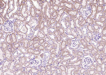 Bax Recombinant Rabbit mAb