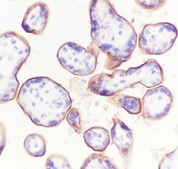 5T4 Recombinant Rabbit Monoclonal Antibody