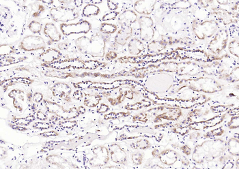 UCHL1+3 Rabbit Polyclonal Antibody