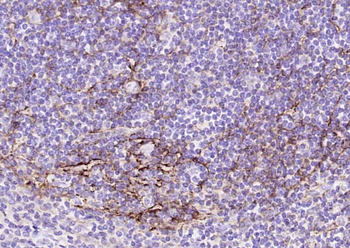 Podoplanin Mouse Monoclonal Antibody