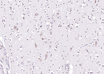 RPL5 Rabbit Polyclonal Antibody