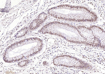 RPL5 Rabbit Polyclonal Antibody