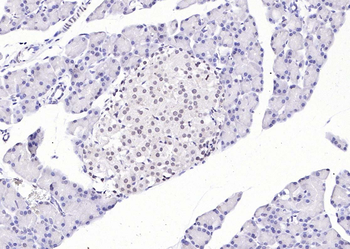 RPL5 Rabbit Polyclonal Antibody