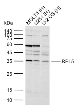 RPL5 Rabbit Polyclonal Antibody