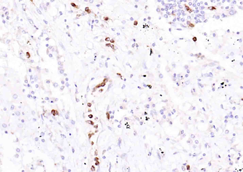 ENOS Rabbit Polyclonal Antibody