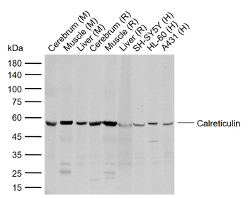 Calreticulin Rabbit Polyclonal Antibody