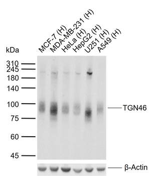 TGN46 Recombinant Rabbit Monoclonal Antibody