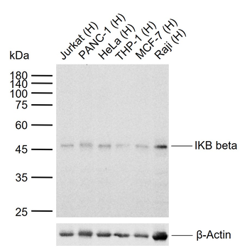 IKB beta Recombinant Rabbit Monoclonal Antibody