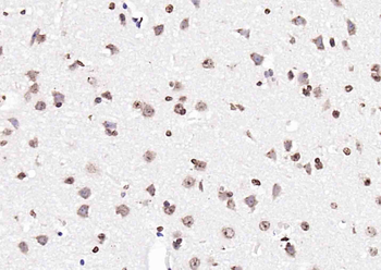 PTGES2 Rabbit Polyclonal Antibody