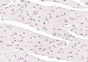 PTGES2 Rabbit Polyclonal Antibody