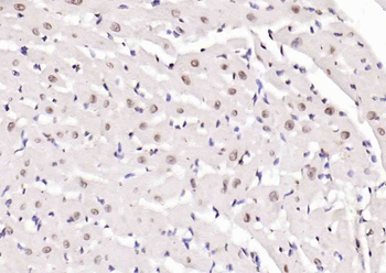 PTGES2 Rabbit Polyclonal Antibody