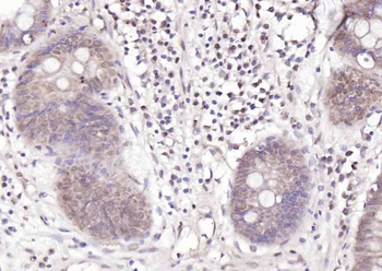 ZCWCC1 Rabbit Polyclonal Antibody