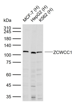 ZCWCC1 Rabbit Polyclonal Antibody
