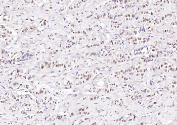 Phospho-PIN1 (Ser71) Rabbit Polyclonal Antibody