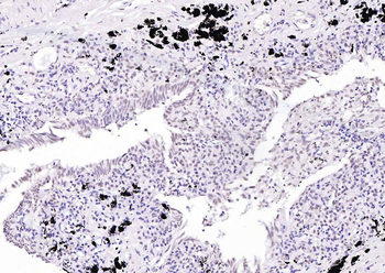 Phospho-PIN1 (Ser71) Rabbit Polyclonal Antibody