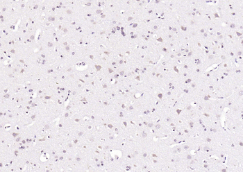 Phospho-PIN1 (Ser71) Rabbit Polyclonal Antibody