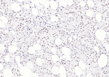 Phospho-PIN1 (Ser16) Rabbit Polyclonal Antibody