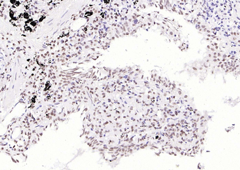 Phospho-PIN1 (Ser16) Rabbit Polyclonal Antibody