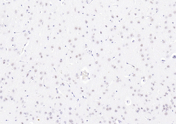 Phospho-PIN1 (Ser16) Rabbit Polyclonal Antibody