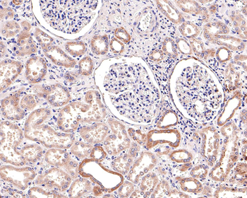 JAK1 Recombinant Rabbit Monoclonal Antibody