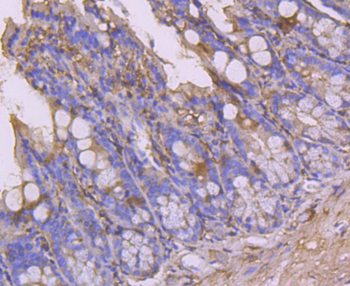 CLOCK Recombinant Rabbit Monoclonal Antibody